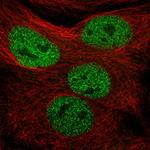 MMS19 Polyclonal Antibody