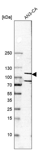 MMS19 Antibody in Western Blot (WB)