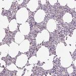 Septin-10 Antibody in Immunohistochemistry (Paraffin) (IHC (P))