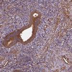 Septin-10 Antibody in Immunohistochemistry (Paraffin) (IHC (P))