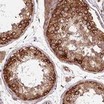 Septin-10 Antibody in Immunohistochemistry (Paraffin) (IHC (P))