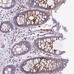 LRRC26 Antibody in Immunohistochemistry (Paraffin) (IHC (P))