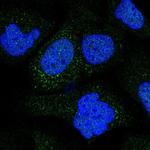 COL9A2 Polyclonal Antibody