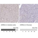 KIRREL3 Polyclonal Antibody