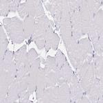 CDH19 Antibody in Immunohistochemistry (Paraffin) (IHC (P))