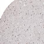 KLHL24 Antibody in Immunohistochemistry (Paraffin) (IHC (P))