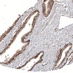 KLHL24 Antibody in Immunohistochemistry (Paraffin) (IHC (P))