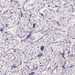 CYP11B1 Antibody in Immunohistochemistry (Paraffin) (IHC (P))