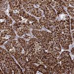 CYP11B1 Antibody in Immunohistochemistry (IHC)