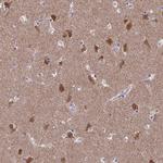 FBXL16 Antibody in Immunohistochemistry (Paraffin) (IHC (P))