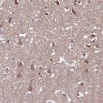 FBXL16 Antibody in Immunohistochemistry (Paraffin) (IHC (P))