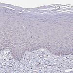 FBXL16 Polyclonal Antibody