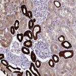 HSD11B2 Antibody in Immunohistochemistry (Paraffin) (IHC (P))