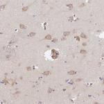 TMEM229A Antibody in Immunohistochemistry (Paraffin) (IHC (P))