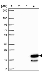 ZNF813 Antibody in Western Blot (WB)