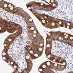 MED9 Antibody in Immunohistochemistry (Paraffin) (IHC (P))