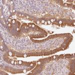 HEBP1 Antibody in Immunohistochemistry (Paraffin) (IHC (P))