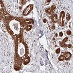 BTF3 Antibody in Immunohistochemistry (Paraffin) (IHC (P))