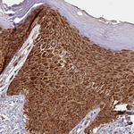 BTF3 Antibody in Immunohistochemistry (Paraffin) (IHC (P))
