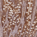 BTF3 Antibody in Immunohistochemistry (Paraffin) (IHC (P))