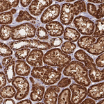 BTF3 Antibody in Immunohistochemistry (Paraffin) (IHC (P))