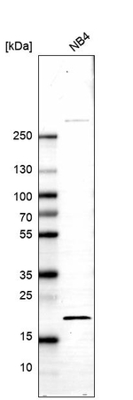 BTF3 Antibody in Western Blot (WB)