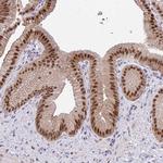 GLIS3 Antibody in Immunohistochemistry (Paraffin) (IHC (P))