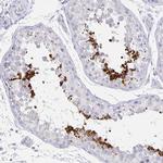 C2orf57 Antibody in Immunohistochemistry (IHC)