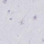 C2orf57 Antibody in Immunohistochemistry (IHC)