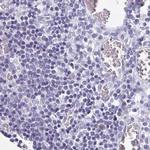 C2orf57 Antibody in Immunohistochemistry (IHC)