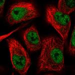 TIMM50 Polyclonal Antibody