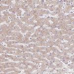 TIMM50 Antibody in Immunohistochemistry (Paraffin) (IHC (P))