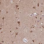 TIMM50 Antibody in Immunohistochemistry (IHC)
