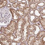 TIMM50 Antibody in Immunohistochemistry (IHC)