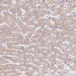 TIMM50 Antibody in Immunohistochemistry (IHC)