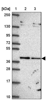 TIMM50 Antibody in Western Blot (WB)