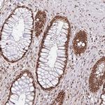 LKAAEAR1 Antibody in Immunohistochemistry (Paraffin) (IHC (P))