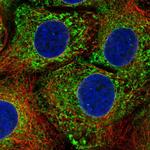 CPVL Polyclonal Antibody