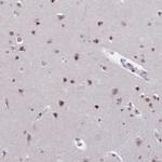 CBX7 Antibody in Immunohistochemistry (Paraffin) (IHC (P))