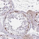 RHOXF1 Polyclonal Antibody