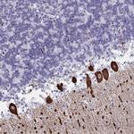 CDX4 Polyclonal Antibody