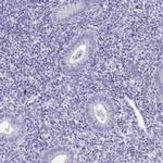 TMCO5A Antibody in Immunohistochemistry (IHC)