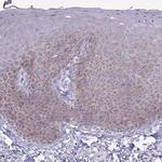 C17orf96 Antibody in Immunohistochemistry (Paraffin) (IHC (P))