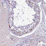 C17orf96 Antibody in Immunohistochemistry (IHC)