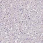 C17orf96 Antibody in Immunohistochemistry (IHC)