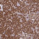 RPS7 Polyclonal Antibody