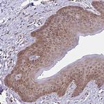 RPS7 Antibody in Immunohistochemistry (Paraffin) (IHC (P))