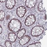 LIN54 Antibody in Immunohistochemistry (Paraffin) (IHC (P))