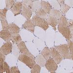 KLHDC7A Antibody in Immunohistochemistry (Paraffin) (IHC (P))