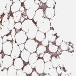 GYLTL1B Polyclonal Antibody